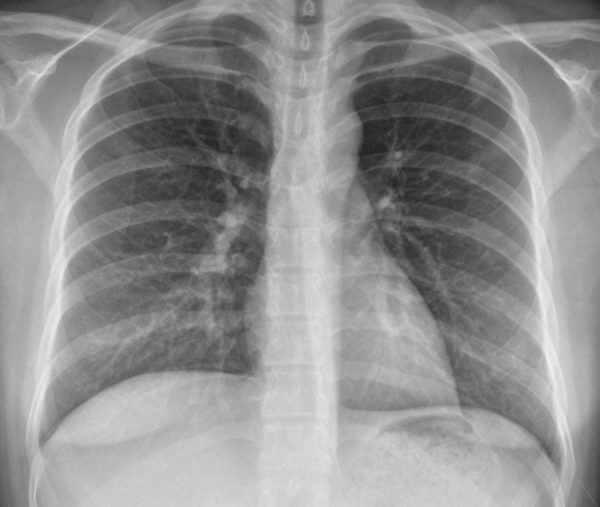 Radiology