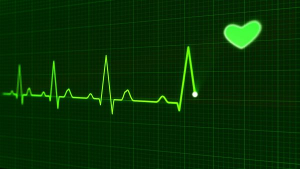 EKGs
